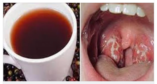 Uno straordinario rimedio naturale contro il mal di gola